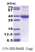 FBXO6 (1-293, His-tag) Human Protein