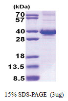 FBXO6 (1-293, His-tag) Human Protein