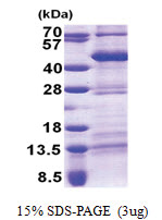 Thyrotroph embryonic factor (TEF) (1-303, His-tag) Human Protein
