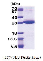 Stomatin / STOM (55-288, His-tag) Human Protein