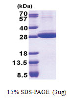 Stomatin / STOM (55-288, His-tag) Human Protein Stomatin / STOM (55-288, His-tag) Human Protein