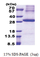 KLK2 / Kallikrein-2 (25-261, His-tag) Human Protein KLK2 / Kallikrein-2 (25-261, His-tag) Human Protein