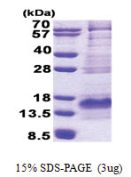 BEX1 (1-125, His-tag) Human Protein BEX1 (1-125, His-tag) Human Protein
