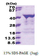 Musashi-2 (1-328, His-tag) Human Protein Musashi-2 (1-328, His-tag) Human Protein