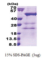 NAT12 (1-362, His-tag) Human Protein NAT12 (1-362, His-tag) Human Protein