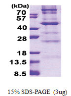 C1GALT1 (30-363, His-tag) Human Protein C1GALT1 (30-363, His-tag) Human Protein
