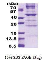 C1GALT1 (30-363, His-tag) Human Protein C1GALT1 (30-363, His-tag) Human Protein