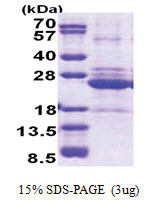 HLA class II DO alpha / HLA-DOA (26-217, His-tag) Human Protein