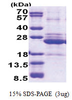 HLA class II DO alpha / HLA-DOA (26-217, His-tag) Human Protein