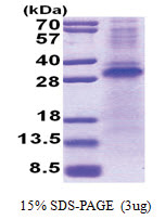 RCHY1 / PIRH2 (1-261, His-tag) Human Protein