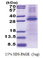 RCHY1 / PIRH2 (1-261, His-tag) Human Protein