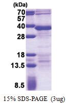 ANKRA1 / RFXANK (1-237, His-tag) Human Protein