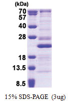 RPL26 (1-145, His-tag) Human Protein