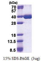 hnRNP-K / HNRNPK (1-276, His-tag) Human Protein