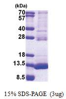 TSTD3 (1-97, His-tag) Human Protein