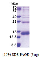 RPS19 (1-145, His-tag) Human Protein