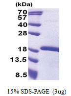 MEOX2 (188-304, His-tag) Human Protein