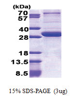 Peroxin 26 / PEX26 (1-246, His-tag) Human Protein