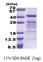 DPPA4 (1-304, His-tag) Human Protein