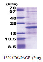 HEN1 (1-133, His-tag) Human Protein