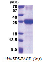 CXADR (20-237, His-tag) Human Protein