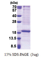 RPL22 (1-128, His-tag) Human Protein