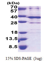 Barttin (54-320, His-tag) Human Protein
