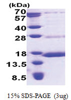 NDUFS6 (28-124, His-tag) Human Protein
