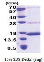 NDUFS6 (28-124, His-tag) Human Protein