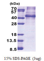 NANOGP8 (1-305) Human Protein