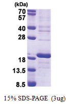 RPS16 (1-146, His-tag) Human Protein