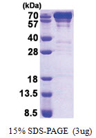 HSPA5 / GRP78 (19-654, His-tag) Human Protein