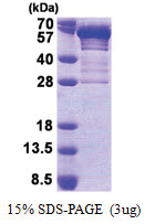 Secretogranin-3 (SCG3) (20-468, His-tag) Human Protein