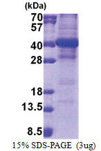 NSL1 (1-281, His-tag) Human Protein