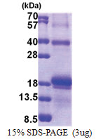 Interleukin-17F / IL17F (31-163, His-tag) Human Protein