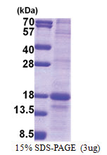 LY86 / MD-1 (21-162, His-tag) Human Protein