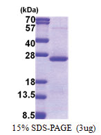 ORM2 / AGP2 (19-201, His-tag) Human Protein