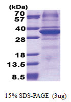 CA11 (24-328, His-tag) Human Protein