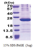 RPL11 (1-178, His-tag) Human Protein