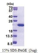 Desert hedgehog / DHH (23-198, His-tag) Human Protein