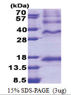 Inhibin beta C chain (INHBC) (237-352, His-tag) Human Protein