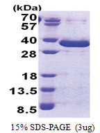 NSE1 (1-292, His-tag) Human Protein