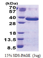 NSE1 (1-292, His-tag) Human Protein