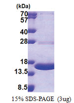 MPZL1 (38-162, His-tag) Human Protein