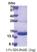MPZL1 (38-162, His-tag) Human Protein