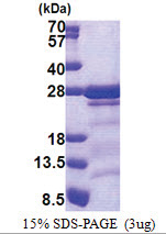 CAMLG (1-189, His-tag) Human Protein