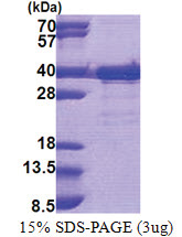 TTC35 (1-297, His-tag) Human Protein