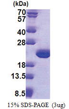 TPPP3 (1-176, His-tag) Human Protein