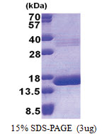 Hemoglobin theta-1 chain (1-142, His-tag) Human Protein