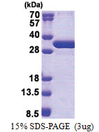 NSMCE1 (1-266, His-tag) Human Protein